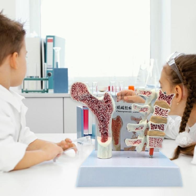 Menschliche Anatomie Osteoporose Modell Wirbel Anatomisches Skelettmodell für Medizinstudenten Lehrdemonstration