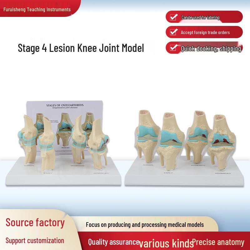 4-Stage Human Knee Evolution Model for Teaching and Display