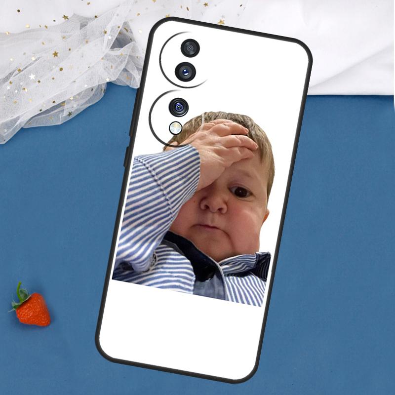 Funny Hasbulla Case For Honor Magic 7 5 6 Lite 8 Pro 200 400 50 70 90 X8c X8b X9a X9b X9c X9d Win RT Cover
