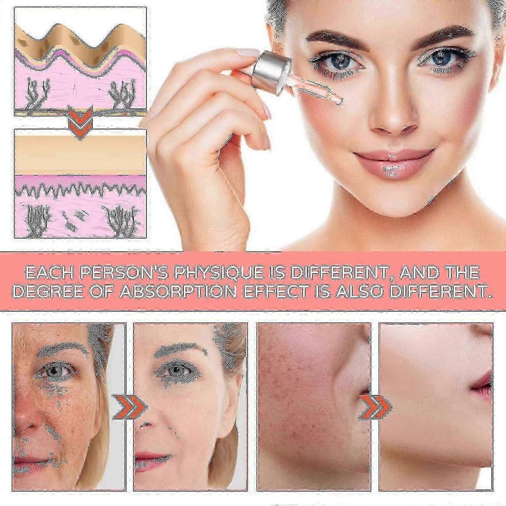 Jaysuing 5-in-1 Gesichtsessenz Befeuchtet die Haut, Anti-Falten, Strafft, Mildert Flecken, Akne, Nährt und Verschönert die Haut |