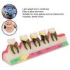 Dental Periodontal Disease Model Tooth Disease Study Teaching Model for Dental School