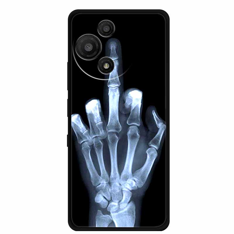 For TCL 60R Case Soft Silicone Cartoon Protective Cover Phone Case for TCL 60 SE NXTpaper 5G Luxury Sci-fi Style Funda TCL 60R