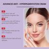 Whitening Freckle Cream Melasma Dark Spots Pigmentation Removal Product Fade Stain Melanin Fast Repair Brighten Korean Skin Care