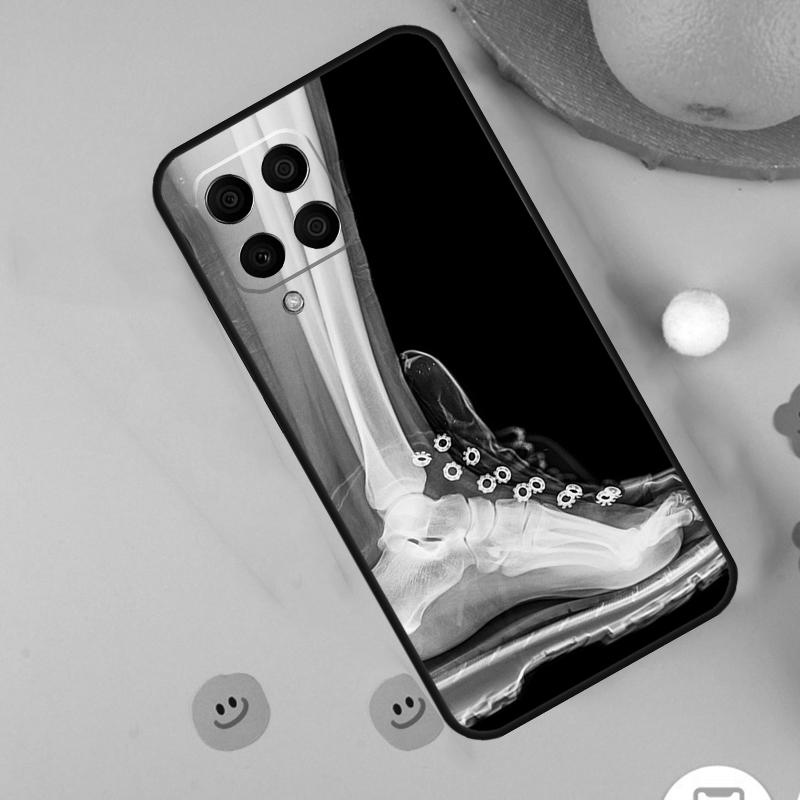 X-Ray Human Anatomy For Samsung Galaxy M54 M34 M14 M12 M32 M52 M53 M33 M13 M20 M21 M51 M15 M55 M31s M30s Case