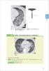 How to write a CT image reading report? - Basic knowledge of anatomy and findings, and examples of reports for common diseases