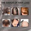 100% reines Rosmarinöl für Haarwachstum & HautpflegeÄtherisches Öl für Augenbrauen und Wimpernjn