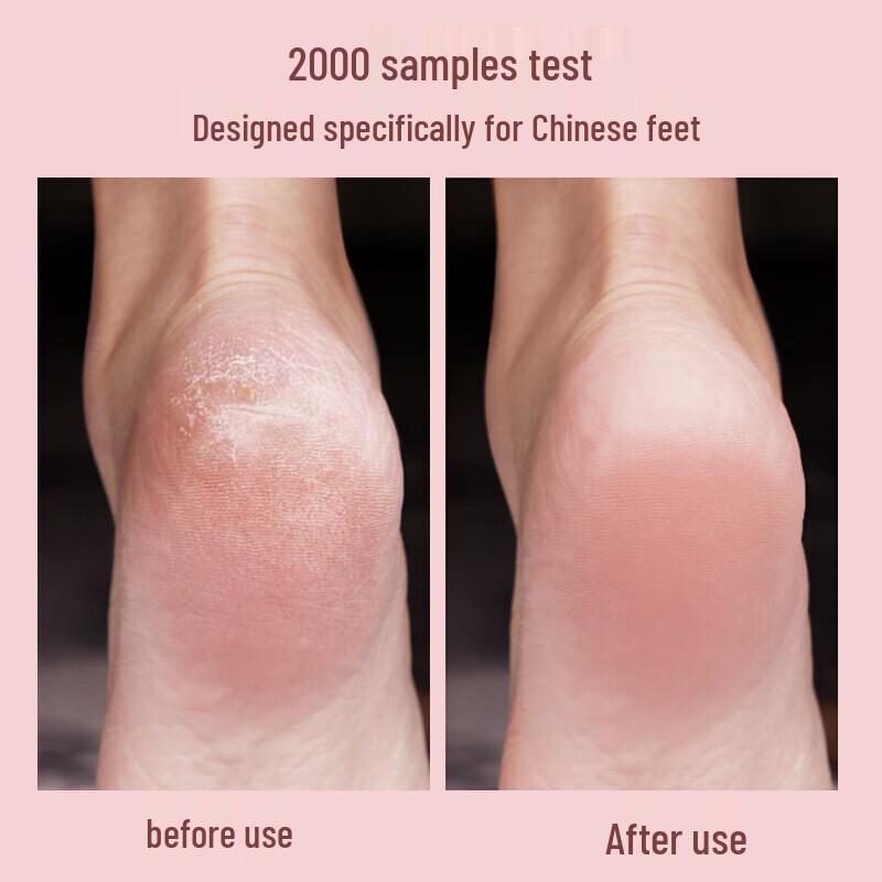 MKS Rechargeable Electric Callus Remover