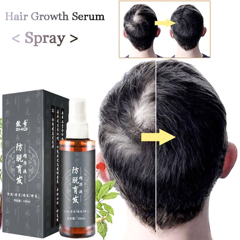 Buy Hair Growth Spray Hair Growth Tonic for Man Anti Hair Loss Oils