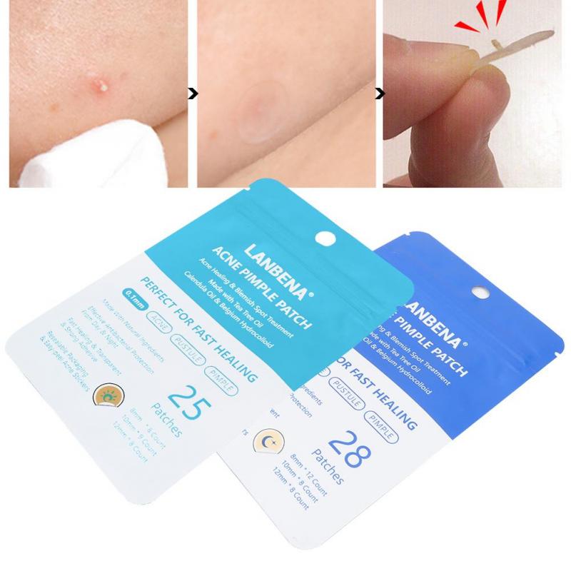 acne pimple patch lanbena