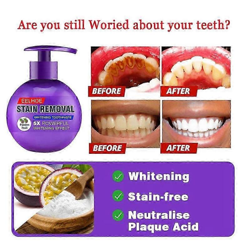 Baking Soda Toothpaste for Stain Removal & Whitening, Fights Bleeding Gums, Deep Cleans & Brightens Teeth, Fresh Breath, 120g
