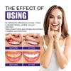 Tooth Whitening Foam Mousse Prevent Periodontitis Toothache Relief Dental Calculus Stain Removal Repair Gums Decay Oral Hygiene