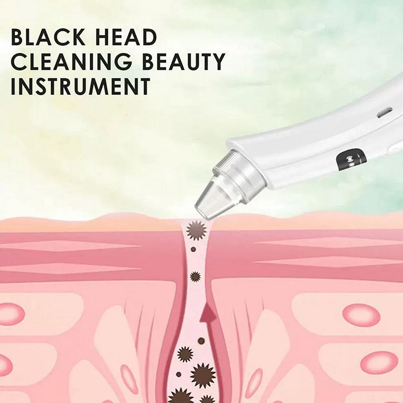 3 Suction Mode Face Cleansing Beauty Machine Dead Skin Remover Face Vacuum Blackhead Removal Skin