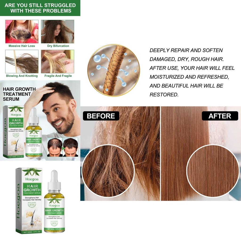 Hoegoa 60ml For Strong Resilient Hair With Natural Fragrance And Non-greasy Finish