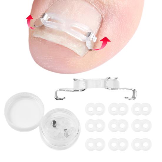 Ingrown Toenail Corrector Kit for Curved Nail Stainless Steel Armor Buckle Toe Nail Straightener Ingrown Nail Tool