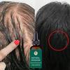 Hair Growth Essence Anti Hair Loss Ginger Treatment