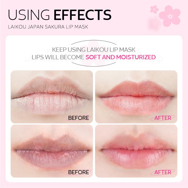 3/5/10 PCS LAIKOU Cherry Blossom Lip Mask 6g Lip Care Moisturizing Nourishing Lip Patch