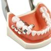 Abrazadera de dique de goma para extensión distal dental, clip de barrera de goma, abrazadera de premolar de acero inoxidable, herramienta de reparación de dientes, 1, 2 o 3 unidades