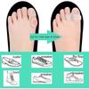 Bunion Gel Toe Separator Toe Separator Band 2 Rings 10 Pack Bunion Corrector for Men and Women for Bunion Relief