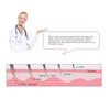 6 IN 1 Derma Roller 12 / 300 / 720 / 1200 Micro Needles Facial Body Skin Beauty Scar Therapy