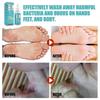 Athlete's Foot Cream for Fast Itch Relief & Fungus Treatment - Antifungal Ointment for Foot Odor, Sweat & Hong Kong Foot - 30g
