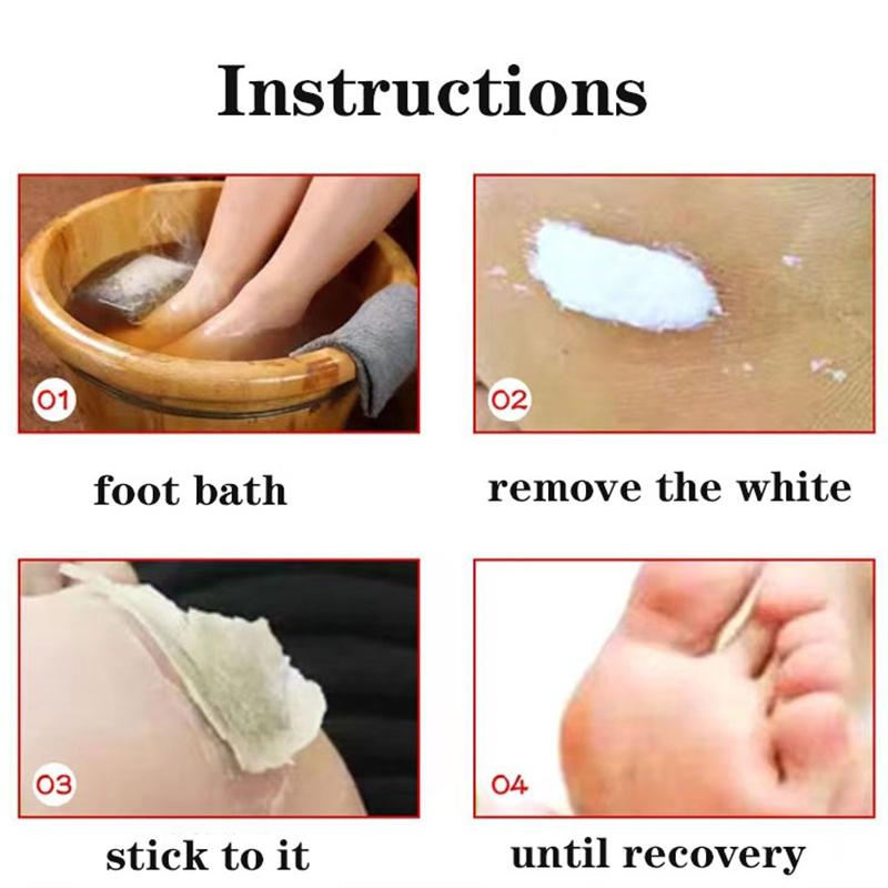 10PCS Healthy Foot Care Patch Painless Treatment Corn Stickers