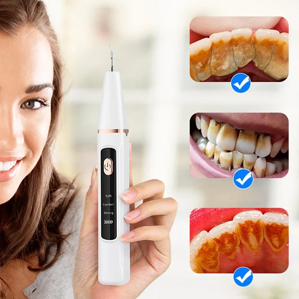 Pulitore Elettrico Sonico per Denti Scaler Dentale ad Ultrasuoni per Tartaro Macchie Pietra Dentale Rimozione Strumento Sbiancante per Denti