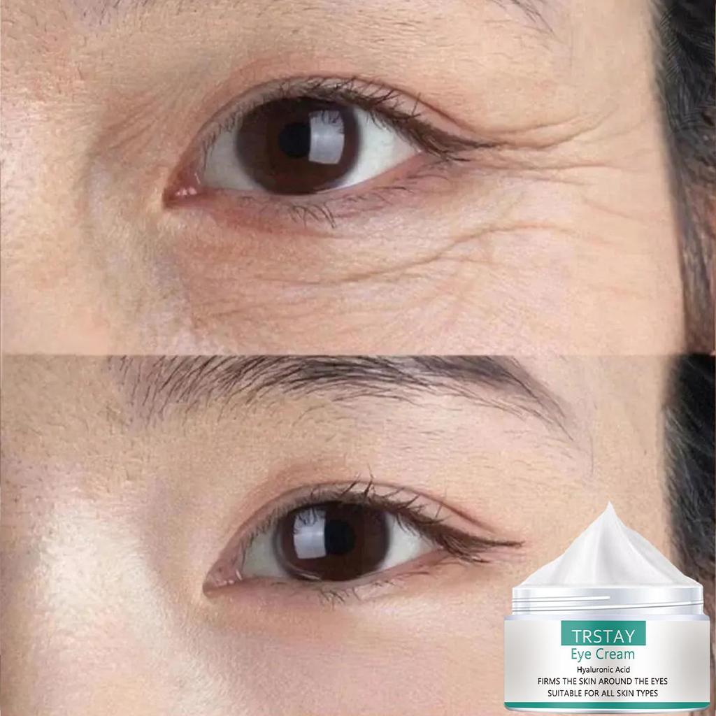 Hydratační oční krém, hladký a jemný, hydratuje, zklidňuje pokožku, redukuje jemné linky, hydratuje pokožku, zlepšuje poškozenou pokožku