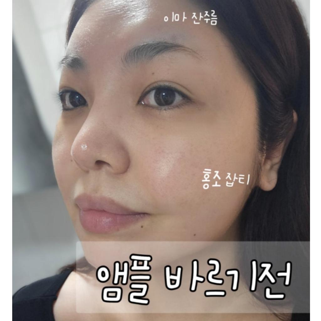 [ARNE] Xcelinu PDRN Skin Booster Ampoule 30ml