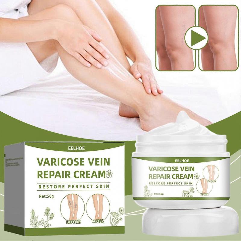 50g Varicose Veins Cream, Effective Varicose And Spider Veins Treatment