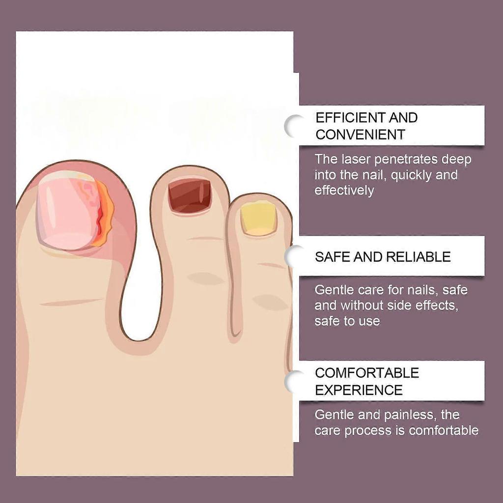 Limited time!!Eohoe Handheld Nail Care Device For Nail Fungus, Gentle Cleaning And Repair For Fingernails And Toenails