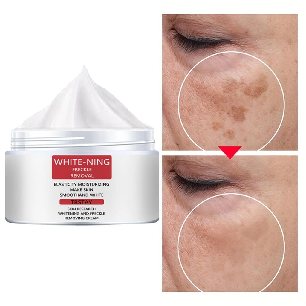 Anti-aging Cream, Rich In Collagen, Prevents Dry Lines, Moisturizes and Moisturizes, Effective Whitening and Freckle Removal Cream