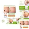 Ouhoe Skin Smoothing Cream Moisturizing Formula For Scar Reduction And Stretch Marks