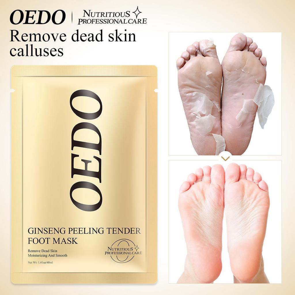 1 חבילה מסיכת רגליים פילינג רגליים קסם פילינג עור הסר עור מת מסכת רגליים גרבי סוסו גרביים לגרבי פדיקור מסיכת כף רגל כף הרגל