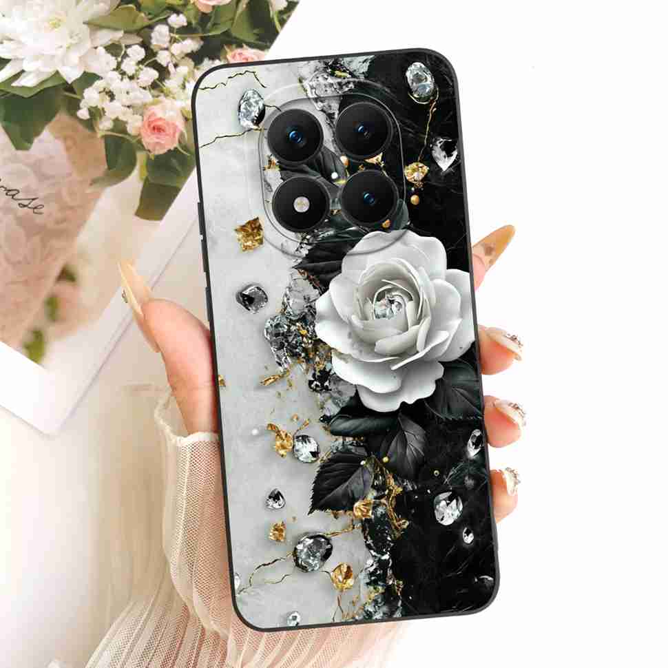 Cartoon Rabbit Case For Redmi Note 15 Pro Casing Cute Soft Phone Cover For Xiaomi Redmi Note15 Note 15 Pro 5G Capa Fundas