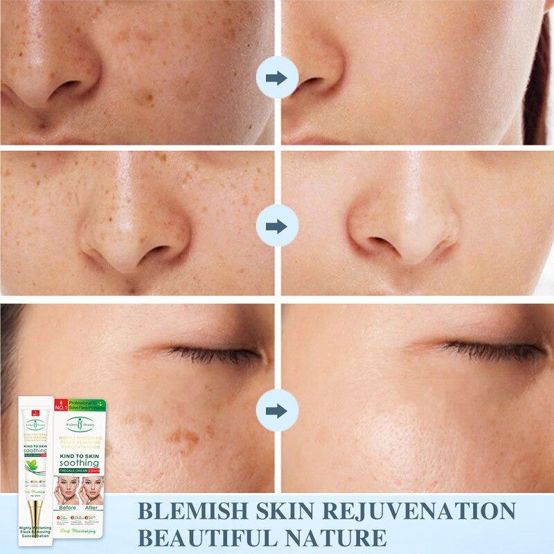 nose dark spot remover cream