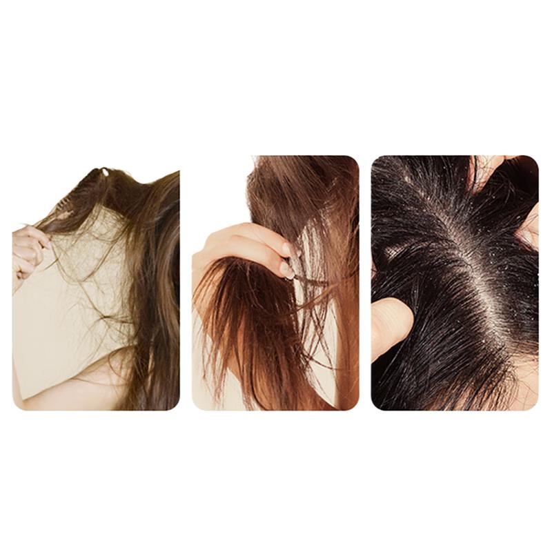 

Shilang Oil Control Anti-Dandruff Shampoo