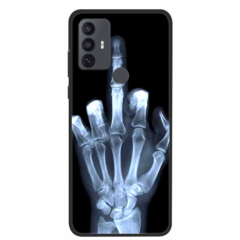 For TCL 30 SE Case Luxury Soft Silicone Protective Animals Phone Cover for TCL 305 306 Case 30SE TPU Funda for TCL30SE Cartoon