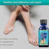 Toenail Fungus Treatment Extra Strength Nail Fungus Treatment for Toenail Nail Repair Solution for Fungal Fingernails & Toenails