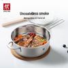 Zwilling TWIN NOVA Plus Cookware Set