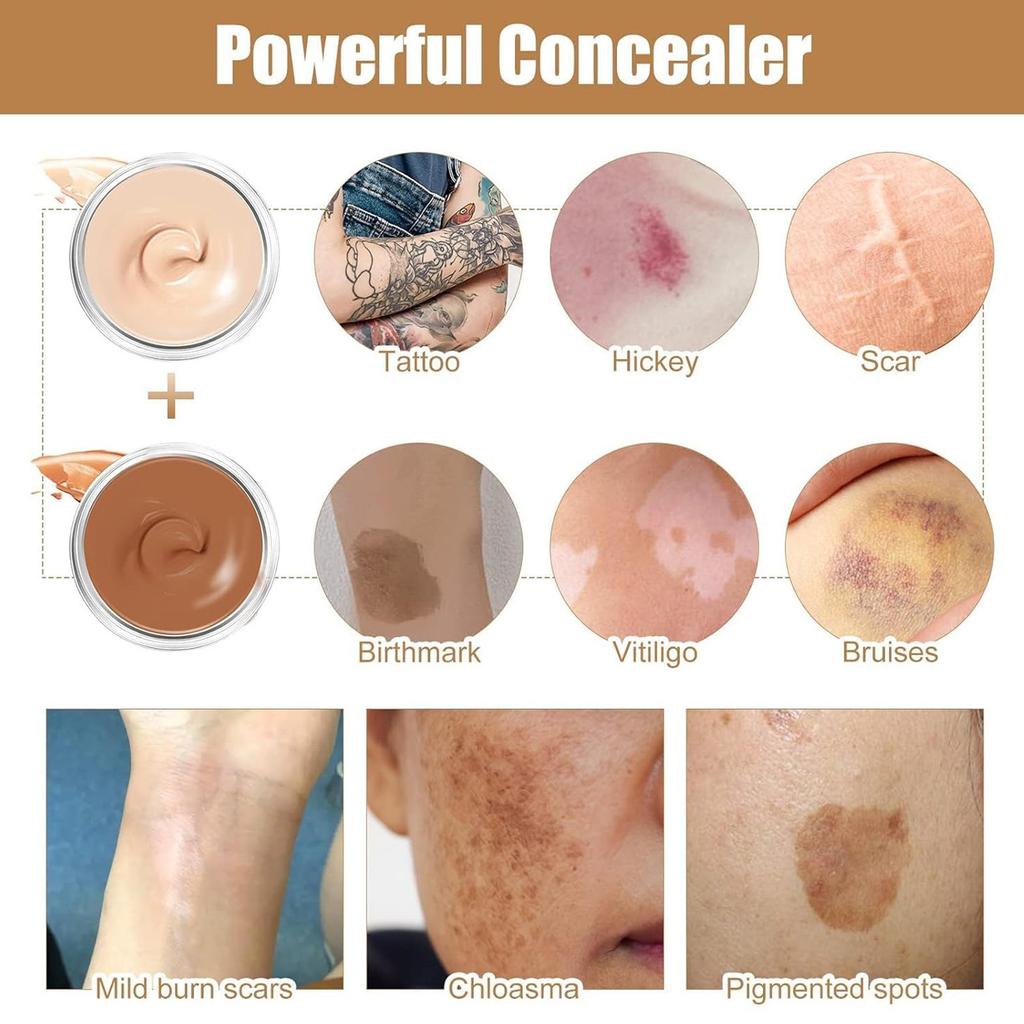 Dark Spots Cover Up 2 Colors Makeup Waterproof Sweatproof Cover Up Skin Concealer Set Long Lasting Suitable For Dark Spots Vitiligo