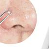 BlackHead Remover Tool Black Head Acne Blemish Pimple Extractor Acne Needles Tweezer Pore Cleaner Face Cleansing Tools Skin Care