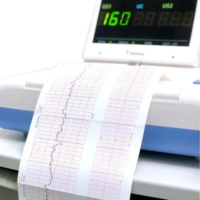 EKG přístroj 50mm*20m/80mm*20/110mm*20m /210mm*20m Elektrokardiograf Termotiskový papír
