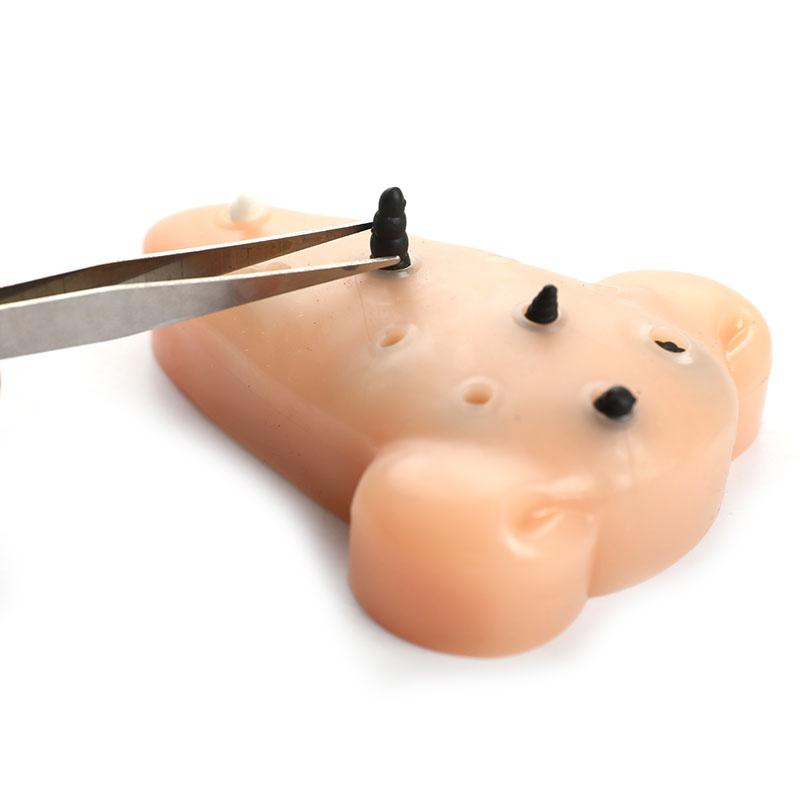 Hračky s černými tečkami, pupínky, vymačkávání akné, úlevu od stresu, hračky, odstraňovače, zastavovací hračky