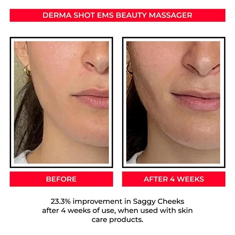 NEW EMS Face Lifting Machine Facial Massager Microcurrent Roller Skin Tightening Rejuvenation Double Chin Removal Beauty Device