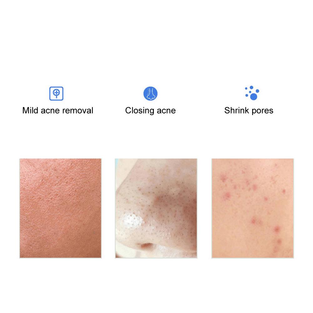 2percent Salicylic Acid Blackhead Acne Removal Cotton Pad Face Cleansing Repair Wipes