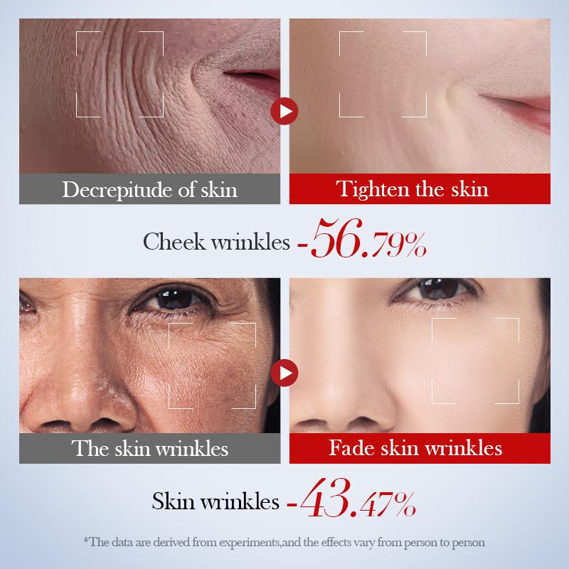 Snail Essence Brightening Double Essence Facial Tightening Whitening Moisturizing Repair Improving Dark Yellow