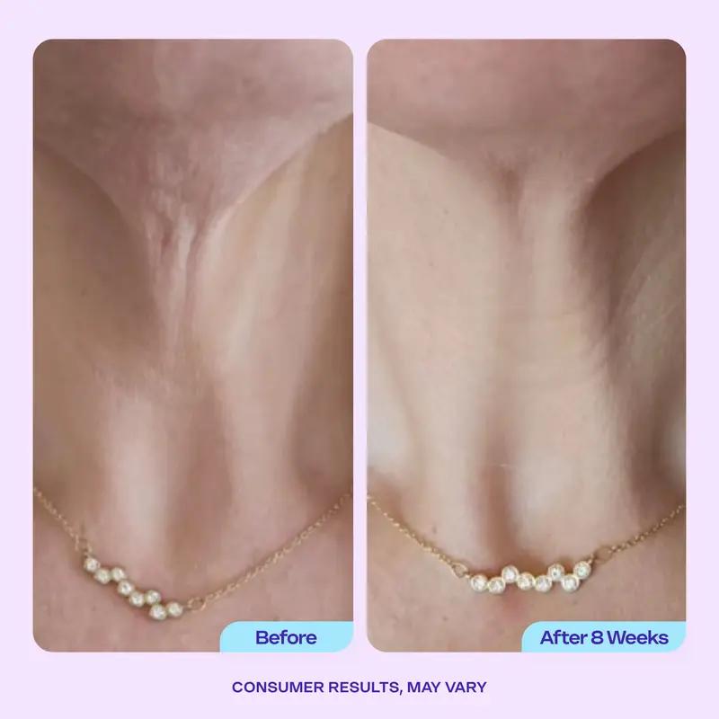 GOPURE Neck Cream Tighten & Lift Firming Cream for Crepey Skin