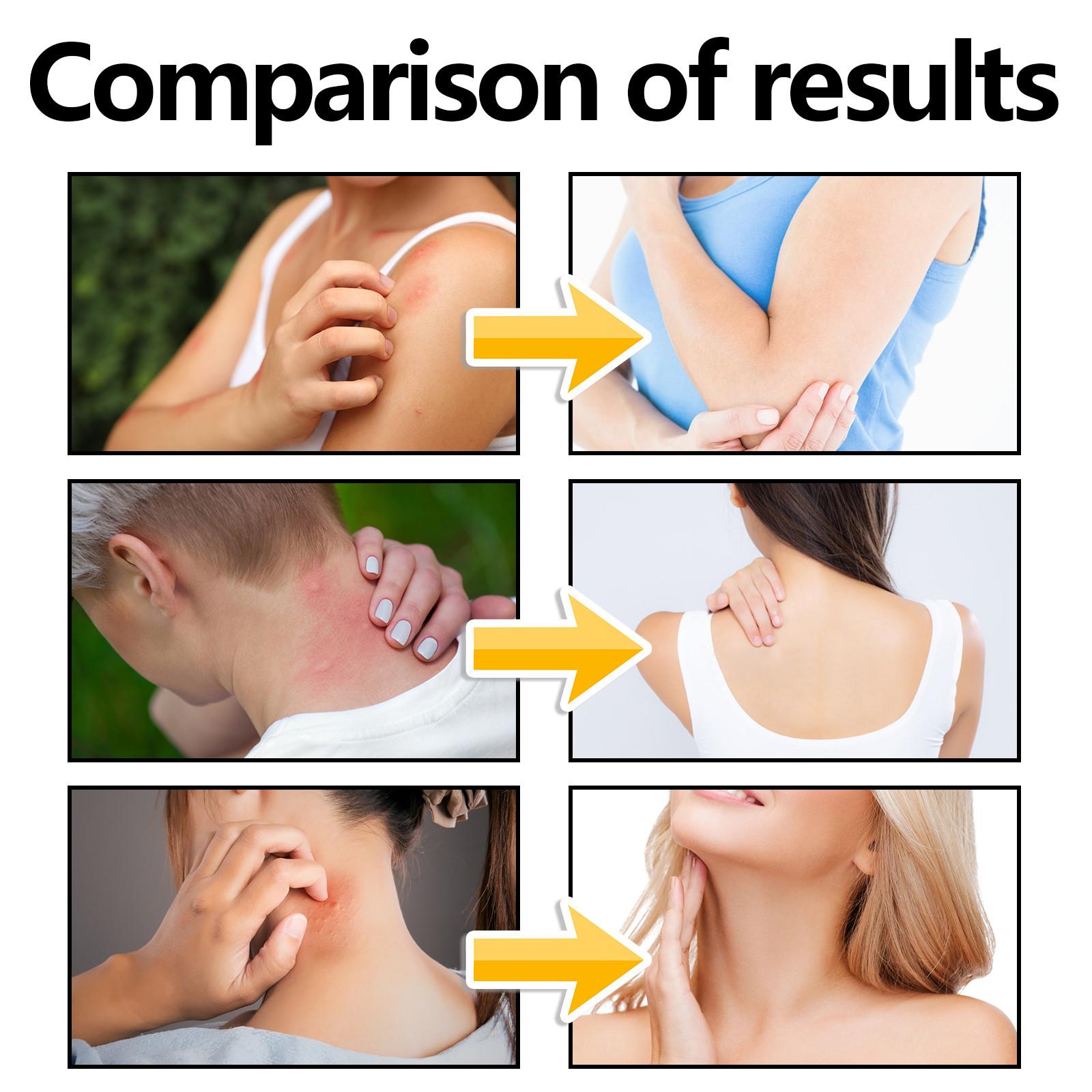 Окопник — фото 6