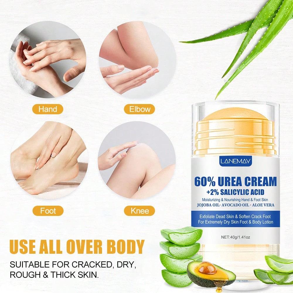 Intensive Urea Foot Cream Repairs Cracked Heels Moisturizes and Smooths Dry Skin On Feet Hands