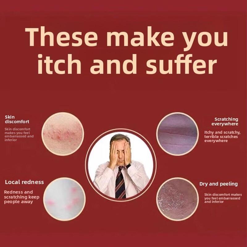 Fast-Acting Itch Relief Cream: Targets Intense Itching from Eczema & Allergic Rashes